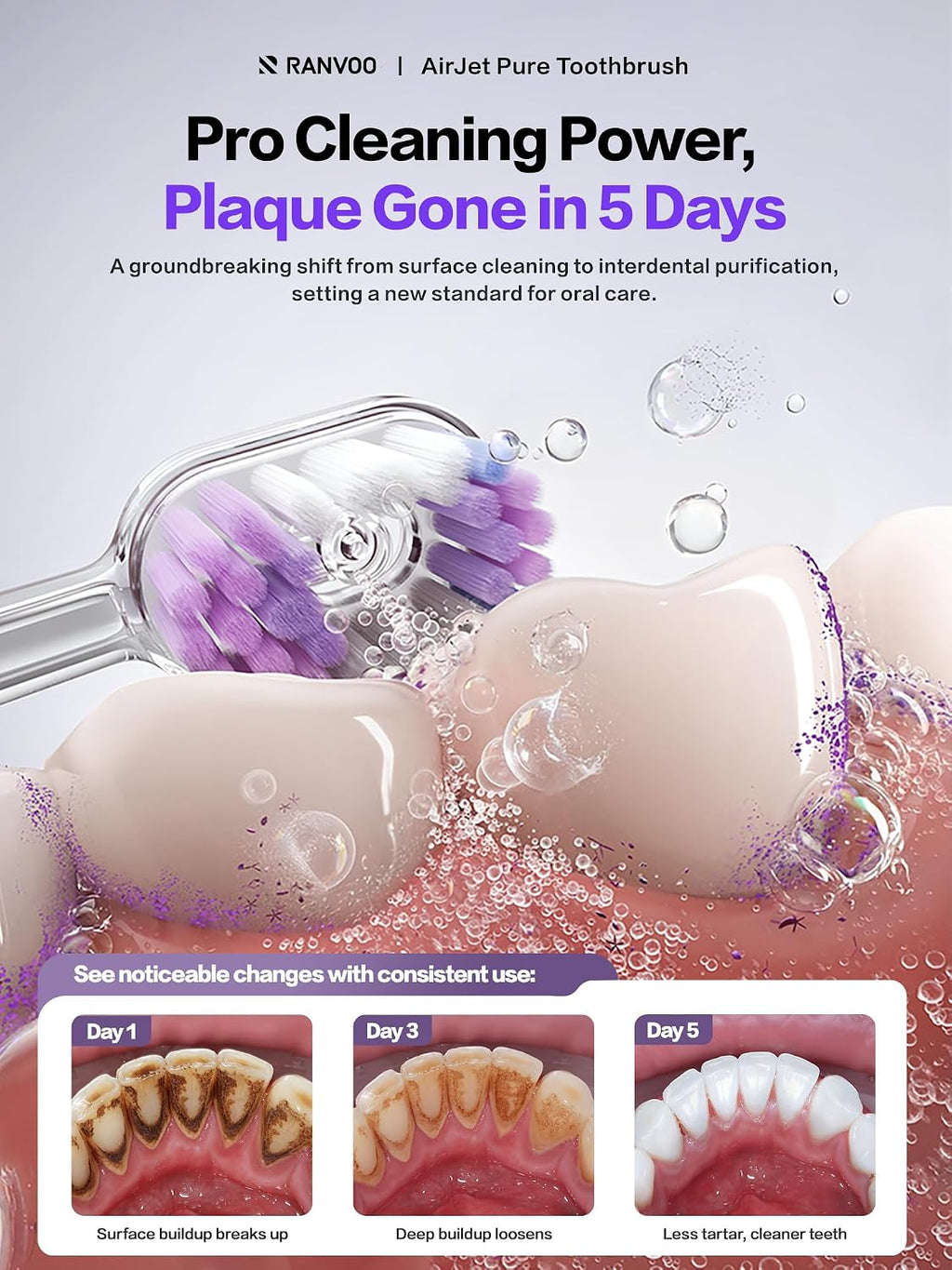 Electric Toothbrush for Adults [New-Generation Bubble Brush Head | Low-Friction Deep Cleaning]
