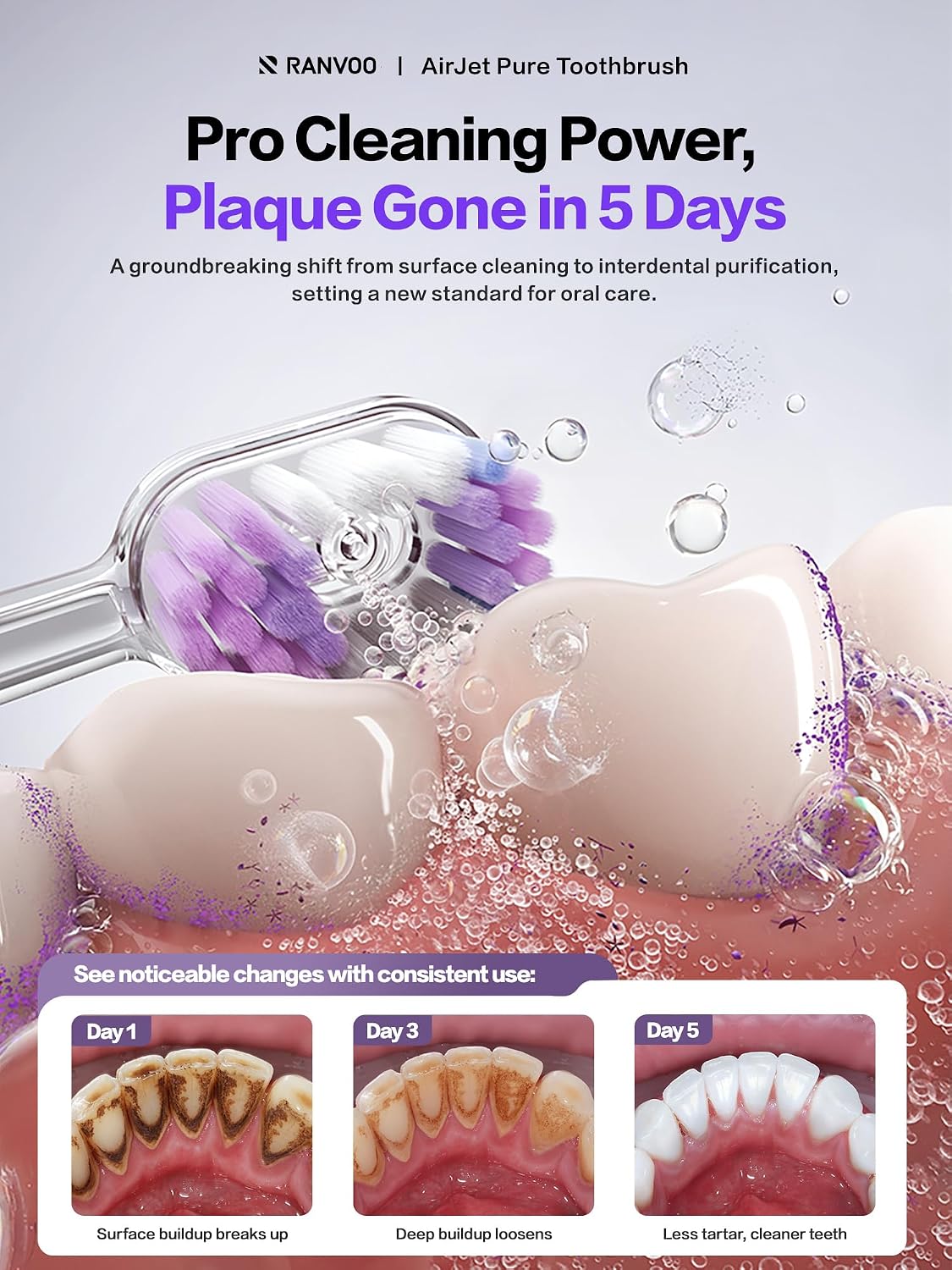 Electric Toothbrush for Adults [New-Generation Bubble Brush Head | Low-Friction Deep Cleaning]
